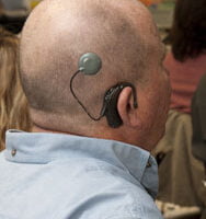 Man wearing cochlear implant