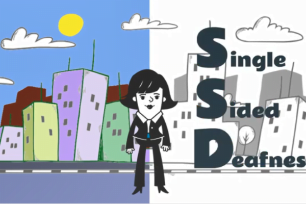 Single sided deafness